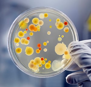 13-gloved-hand-holding-petri-dish-bacteria-culture-medical